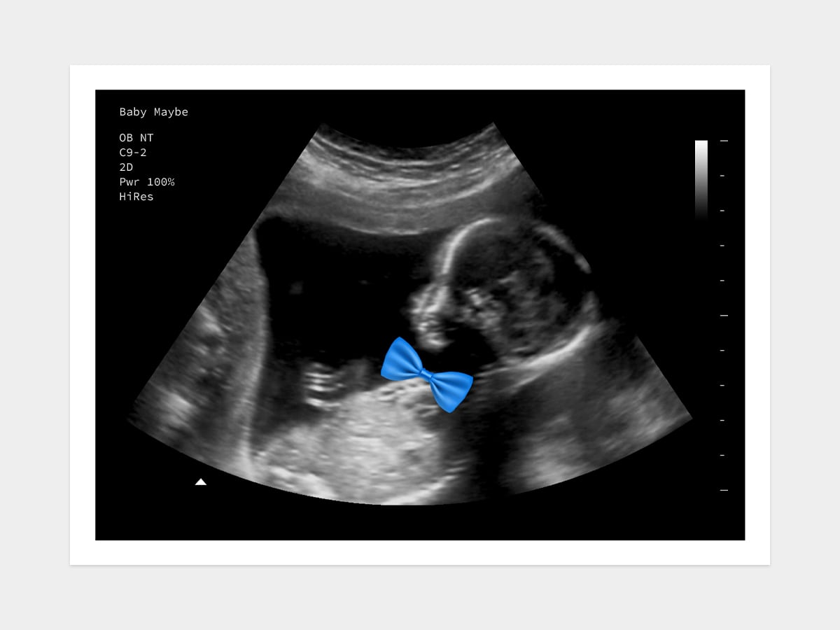 Blue Bowtie Gender Reveal Fake Ultrasound image
