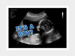 Its a Boy Gender Reveal Fake Ultrasound image