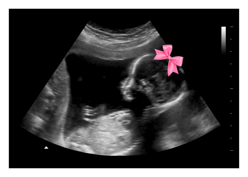 Pink Bow Gender Reveal Fake Ultrasound