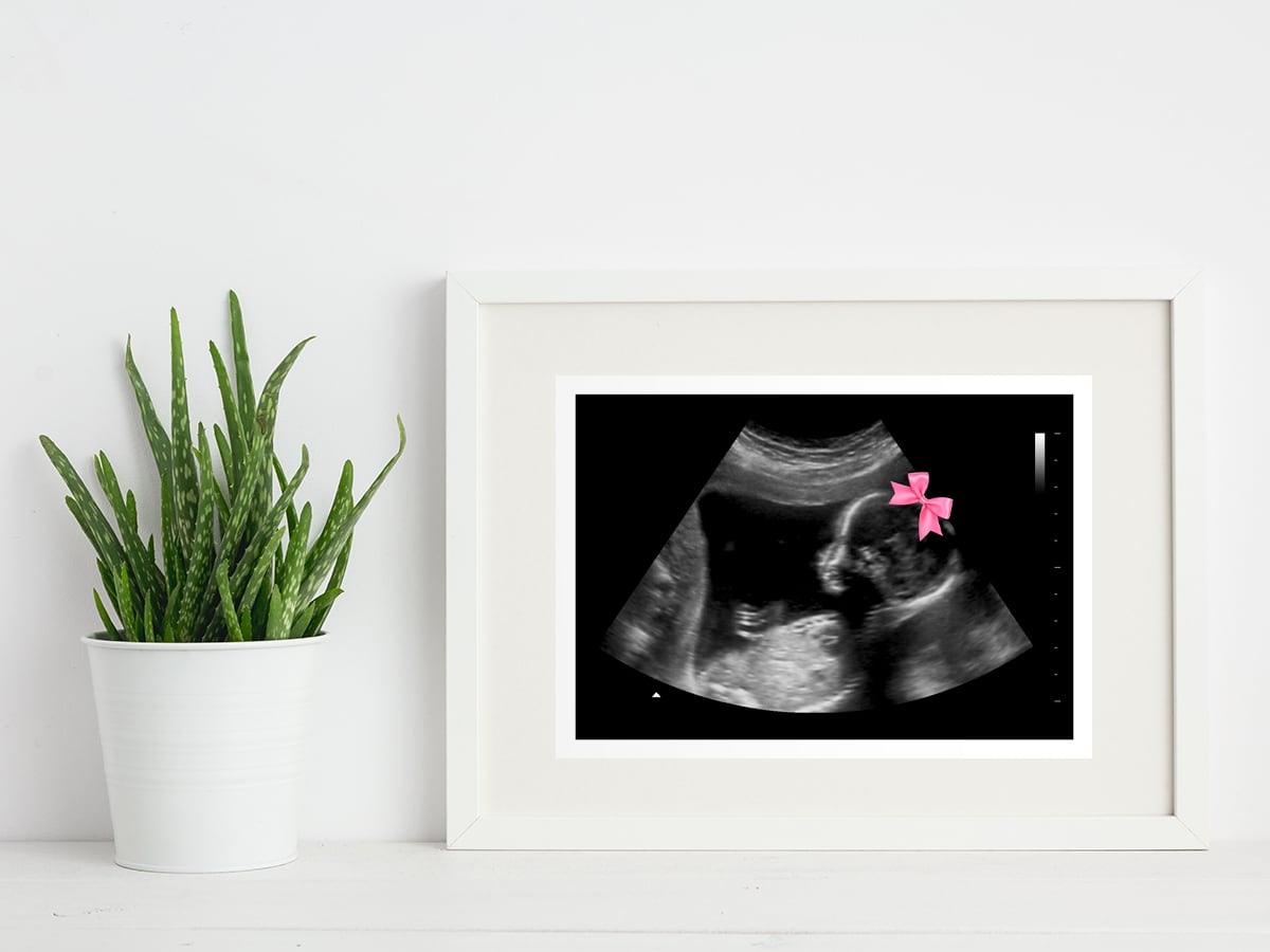 Pink Bow Gender Reveal Fake Ultrasound in a frame