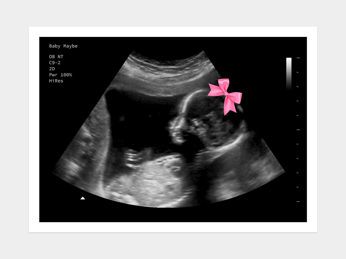 Pink Bow Gender Reveal Fake Ultrasound image