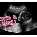 Its a Girl Gender Reveal Fake Ultrasound