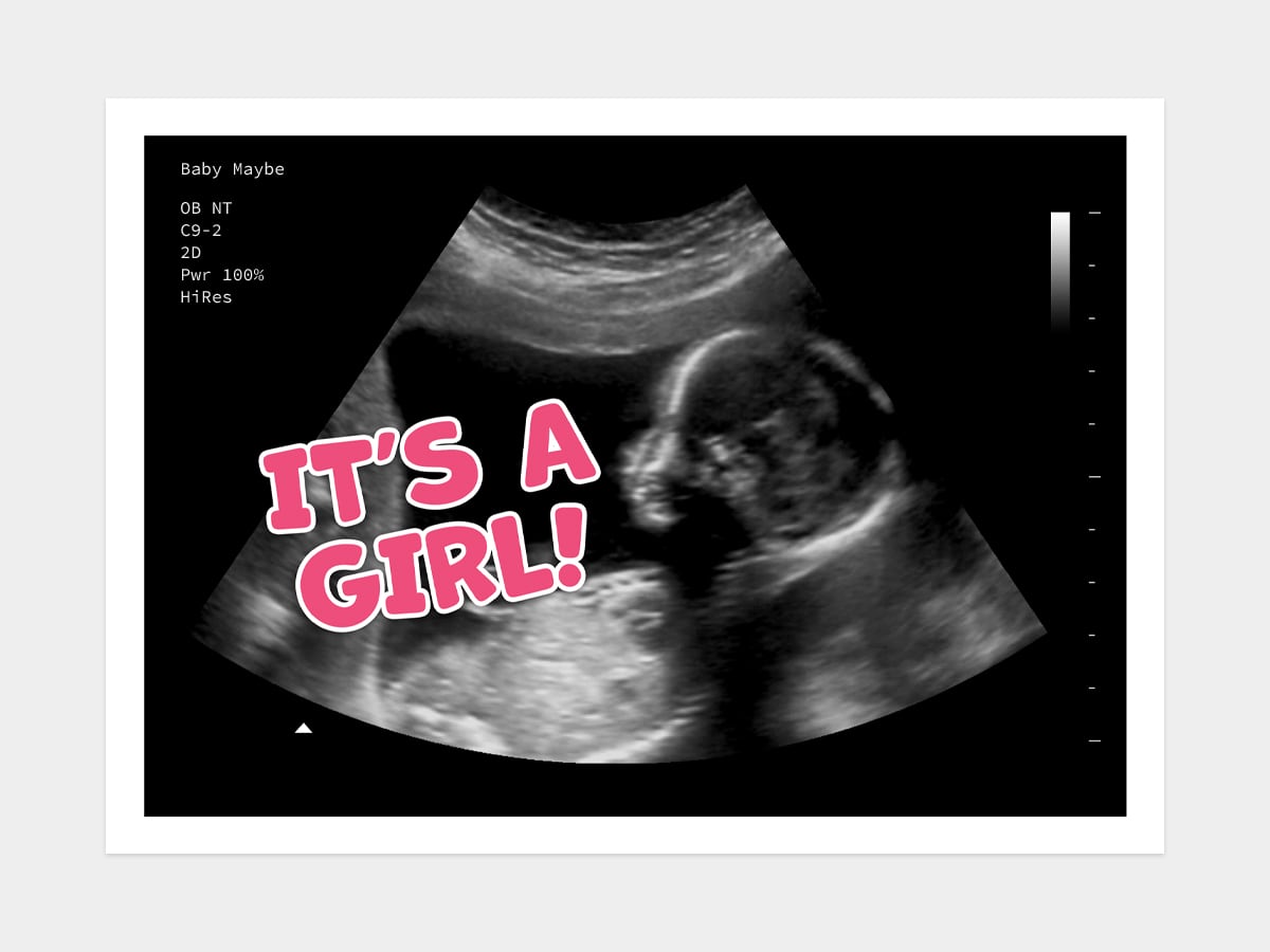 Its a Girl Gender Reveal Fake Ultrasound image
