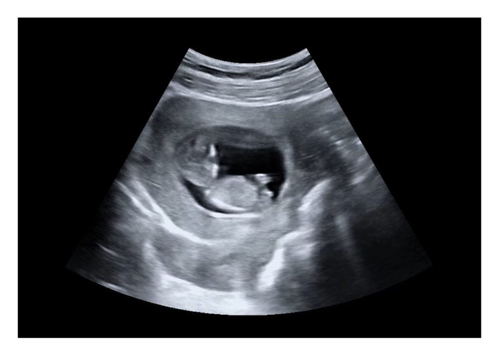12-Weeks Fake Ultrasound HD Video