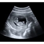 12-Weeks Fake Ultrasound HD Video - Video + Digital PDF