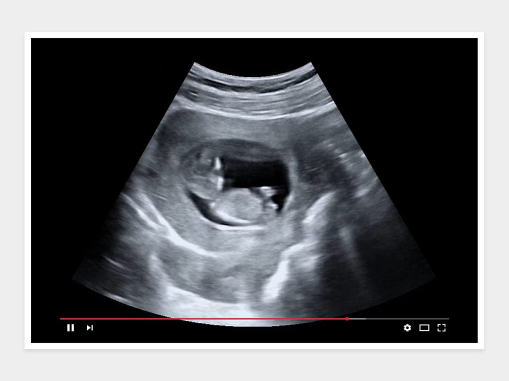 Fake Ultrasound Videos | Instant Digital Delivery | Baby Maybe
