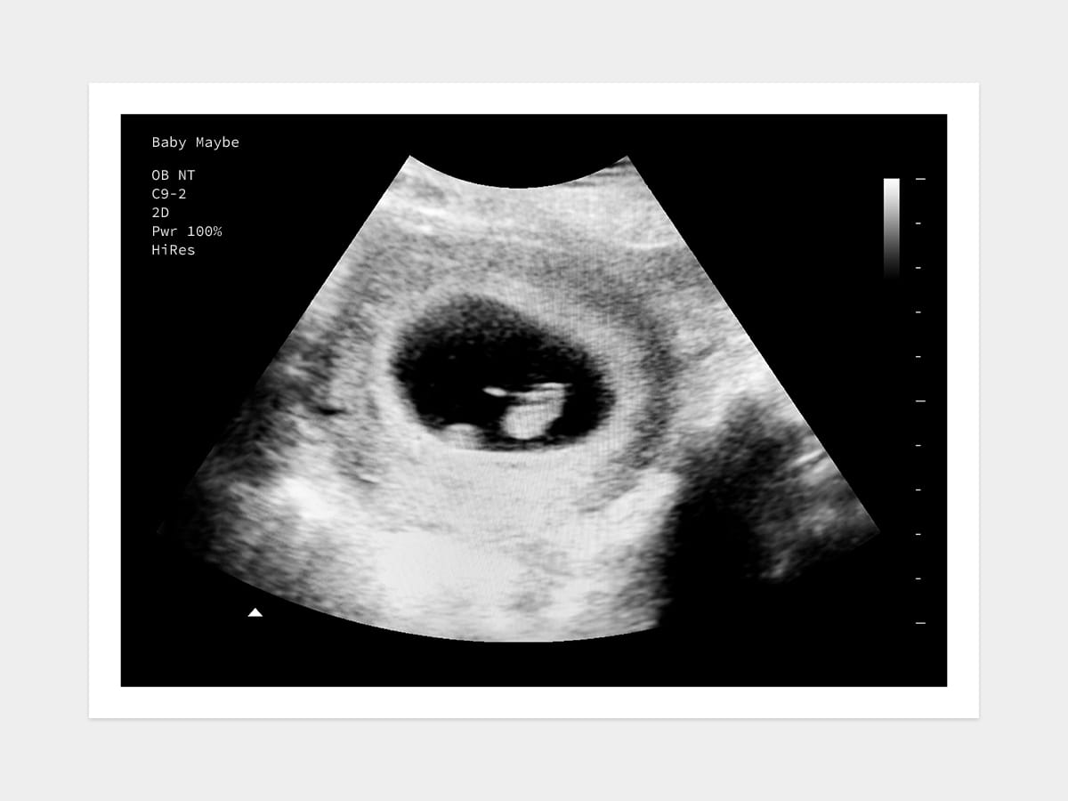 6 weeks ultrasound image