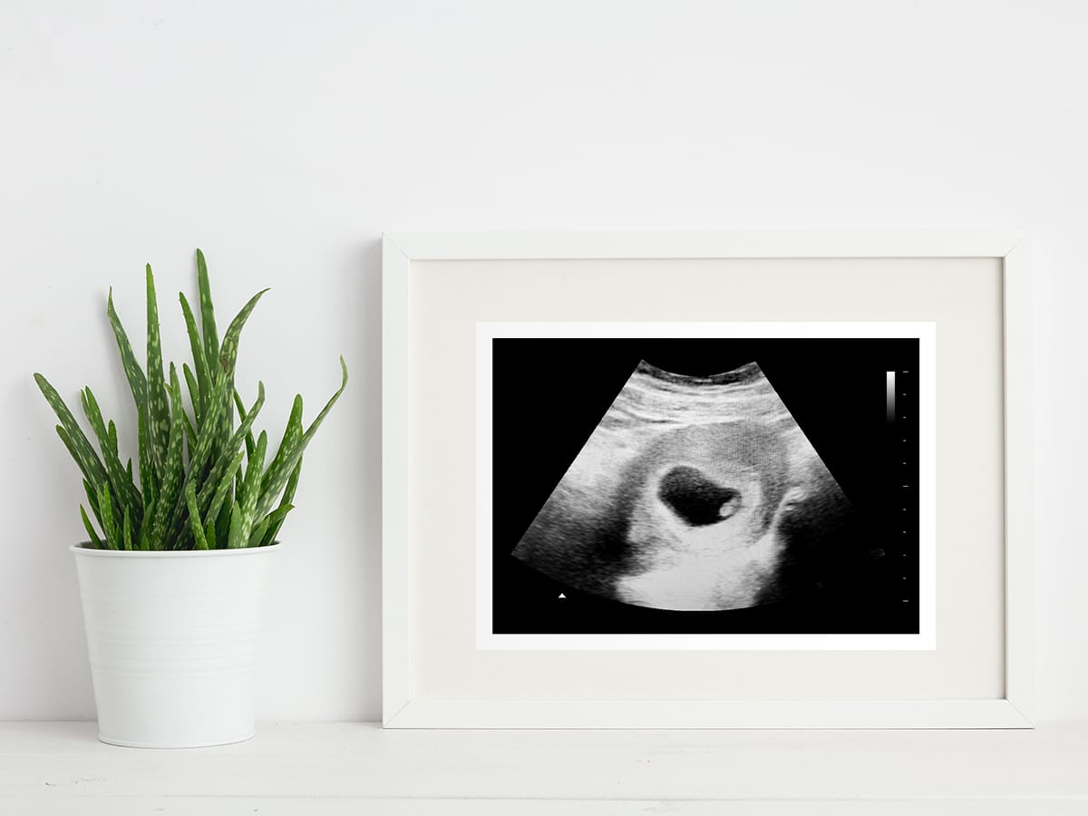 6 weeks ultrasound in a frame