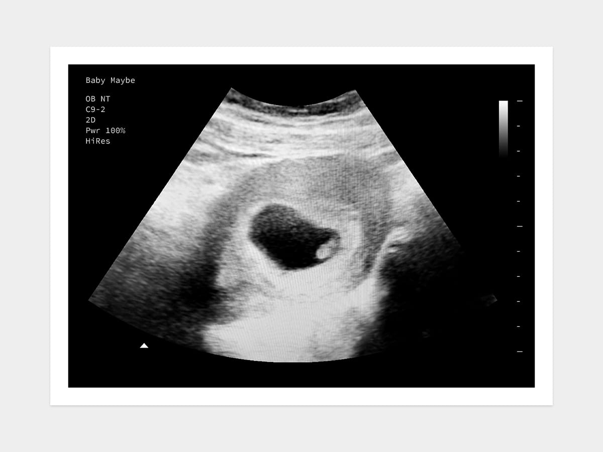 Information Of Pregnancy Ultrasound Week By Week Masacredeavellaneda 