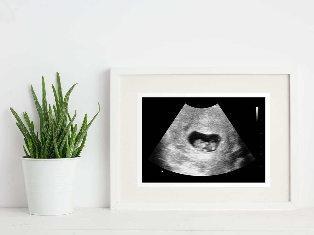 7 weeks ultrasound in a frame