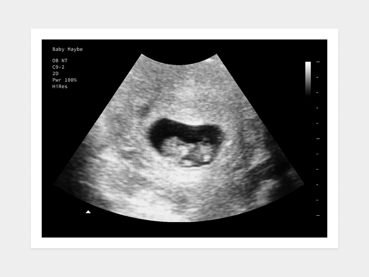 7 weeks ultrasound image