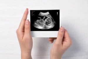 Isolated hands holding a fake ultrasound