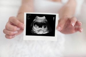 Isolated hands holding a fake ultrasound