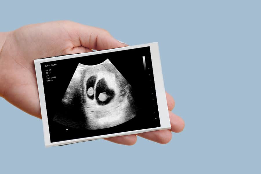 Isolated hands holding a fake ultrasound on a blue background