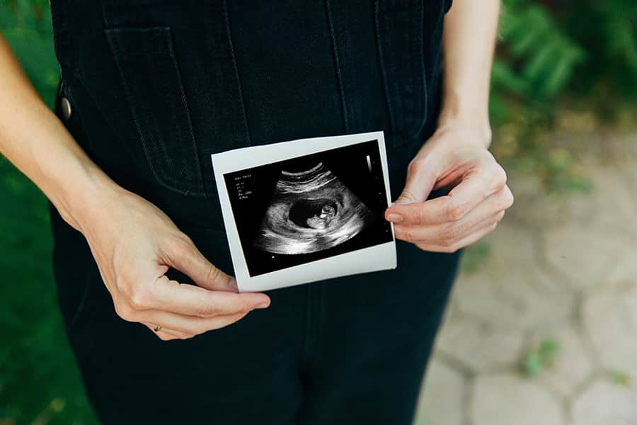 A woman outside holding a fake ultrasound