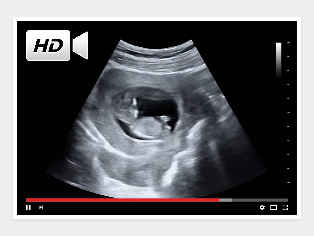 12 weeks ultrasound video