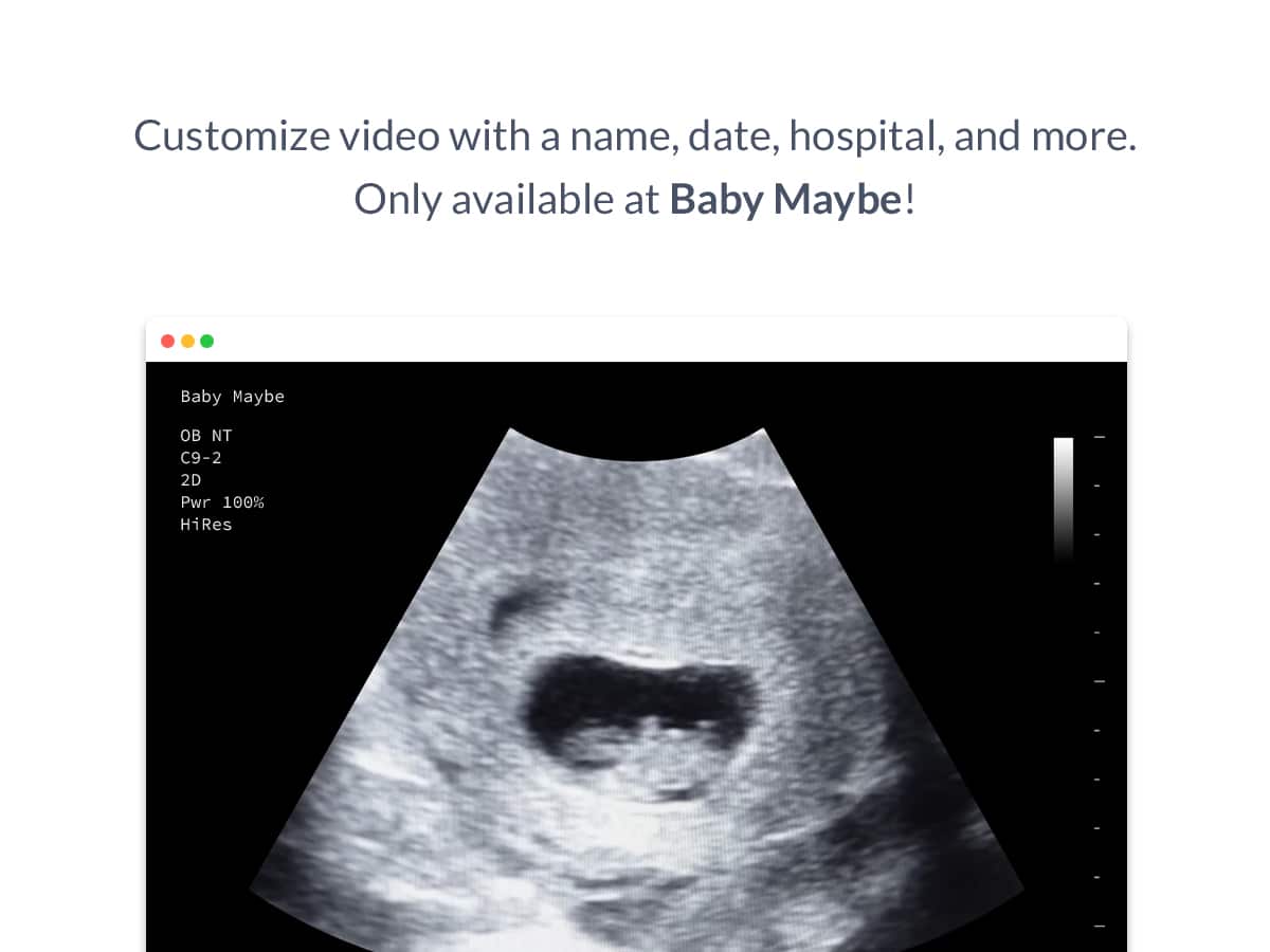 7 weeks ultrasound video customized