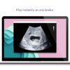 7 weeks ultrasound video play on any device