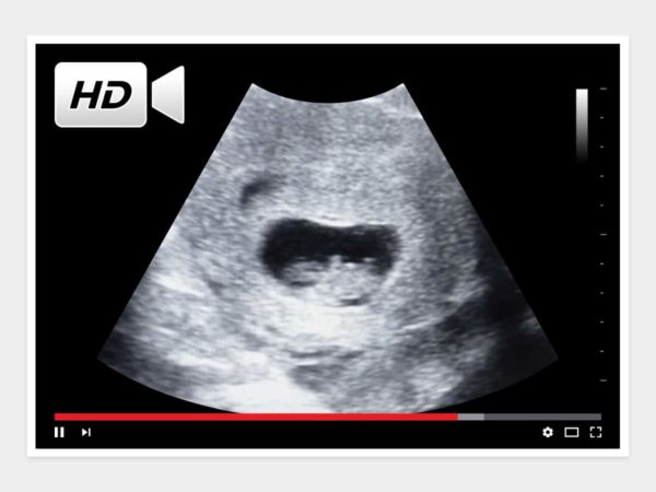 7 weeks ultrasound video