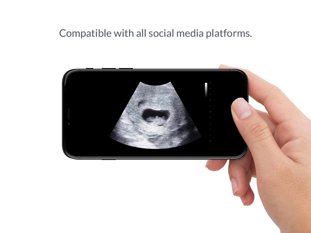 7 weeks ultrasound video social media compatible